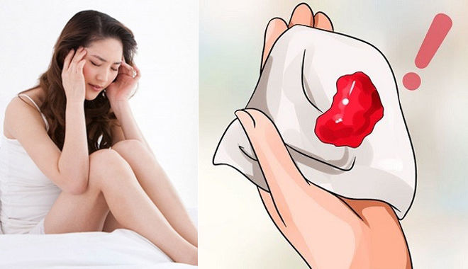 ứng phó với kinh nguyệt